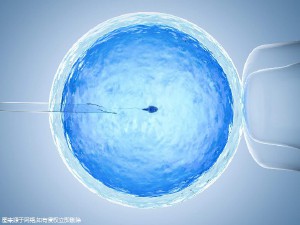 男性因素